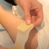 NeedleCalm in use on an arm