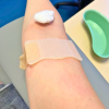 NeedleCalm in use on an arm
