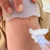 NeedleCalm in use on an arm