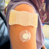 Successful NeedleCalm Needle Procedure