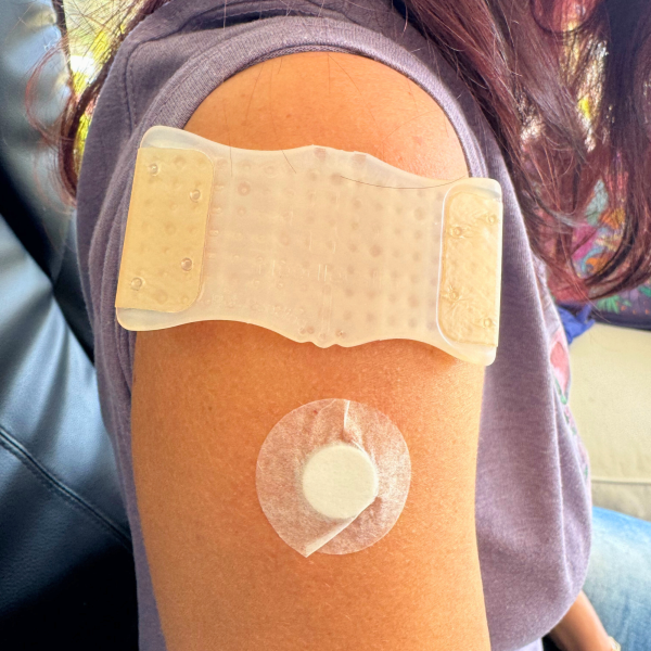 Successful NeedleCalm Needle Procedure